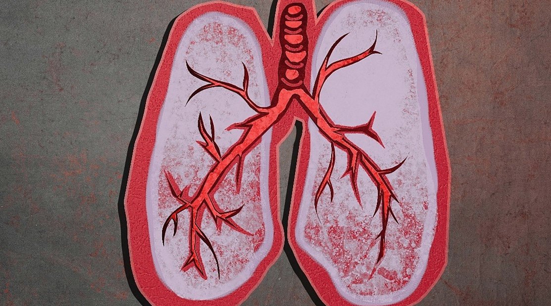How Daily Habits and Environment Can Shape Your Lung Cancer Risk